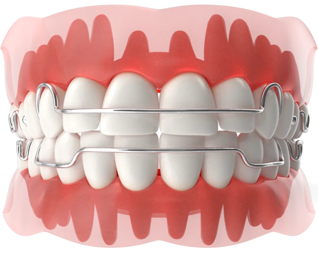 유지장치 관리 실패 케이스 분석