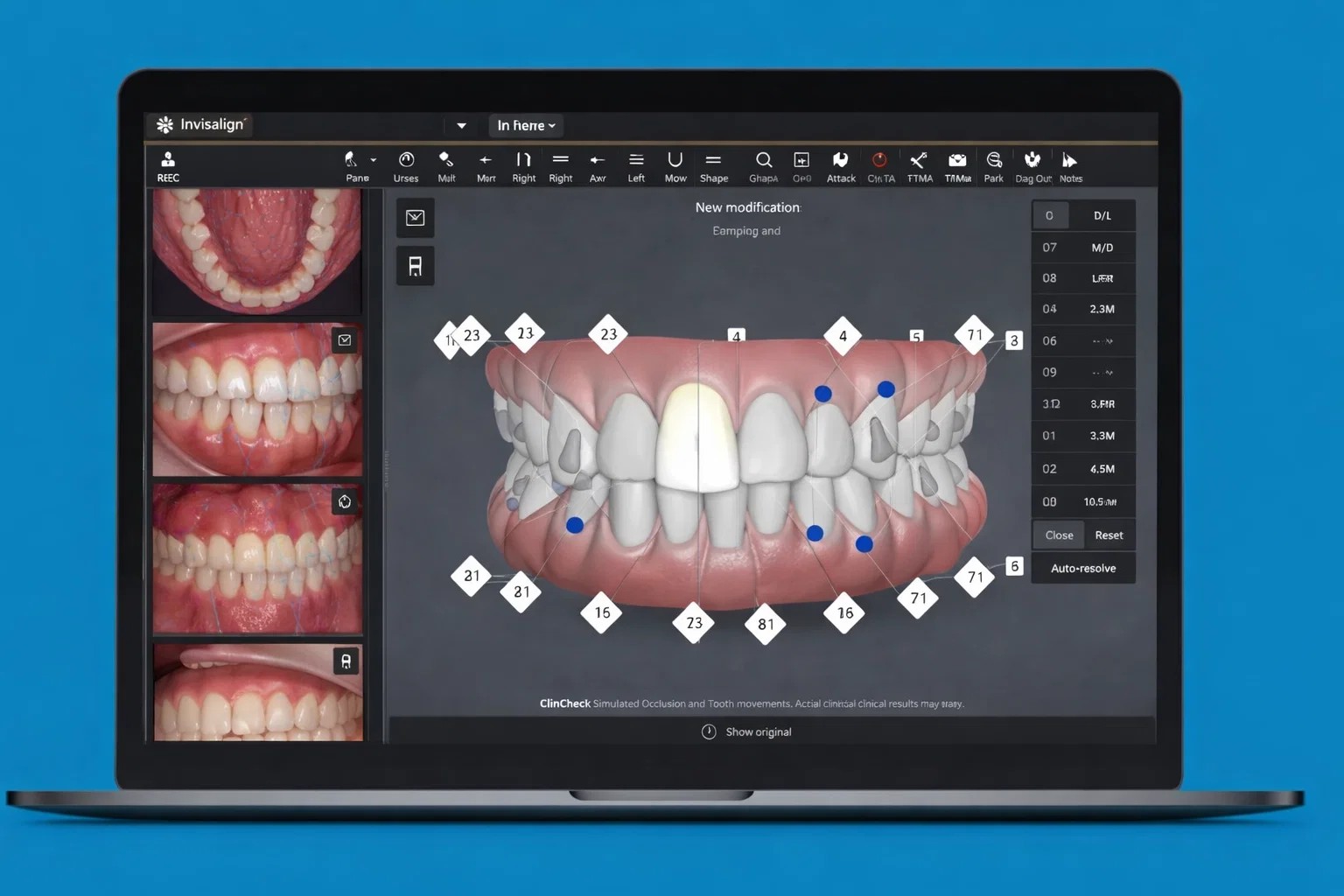 클린첵 디지털 치료 시뮬레이션